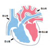 生活習慣病は不整脈を招く